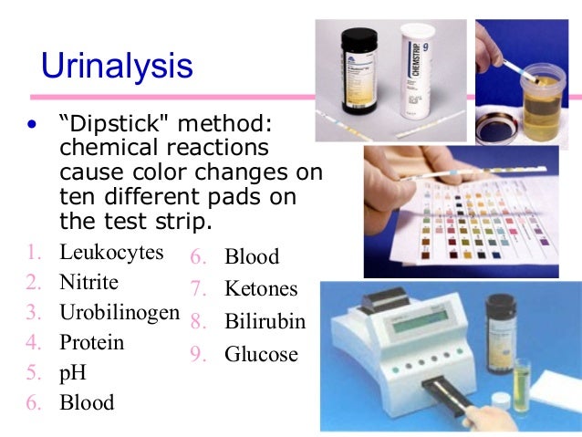 glucose 6.6 blood test Urinalysis glucose 6.6 blood test Urinalysis