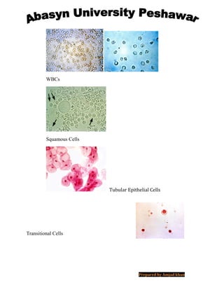 WBCs
Squamous Cells
Tubular Epithelial Cells
Transitional Cells
Prepared by Amjad khan
 