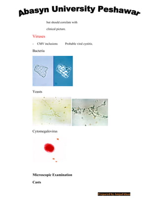 but should correlate with
clinical picture.
Viruses
- CMV inclusions Probable viral cystitis.
Bacteria
Yeasts
Cytomegalovirus
Microscopic Examination
Casts
Prepared by Amjad khan
 