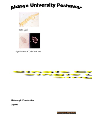 Fatty Cast
Significance of Cellular Casts
Microscopic Examination
Crystals
Prepared by Amjad khan
 