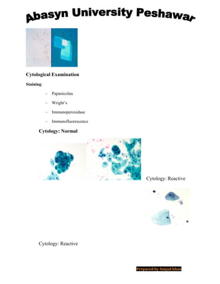 Cytological Examination
Staining:
– Papanicolau
– Wright’s
– Immunoperoxidase
– Immunofluorescence
Cytology: Normal
Cytology: Reactive
Cytology: Reactive
Prepared by Amjad khan
 