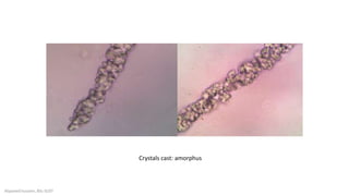 Urinalysis a comprehensive review | PPTX