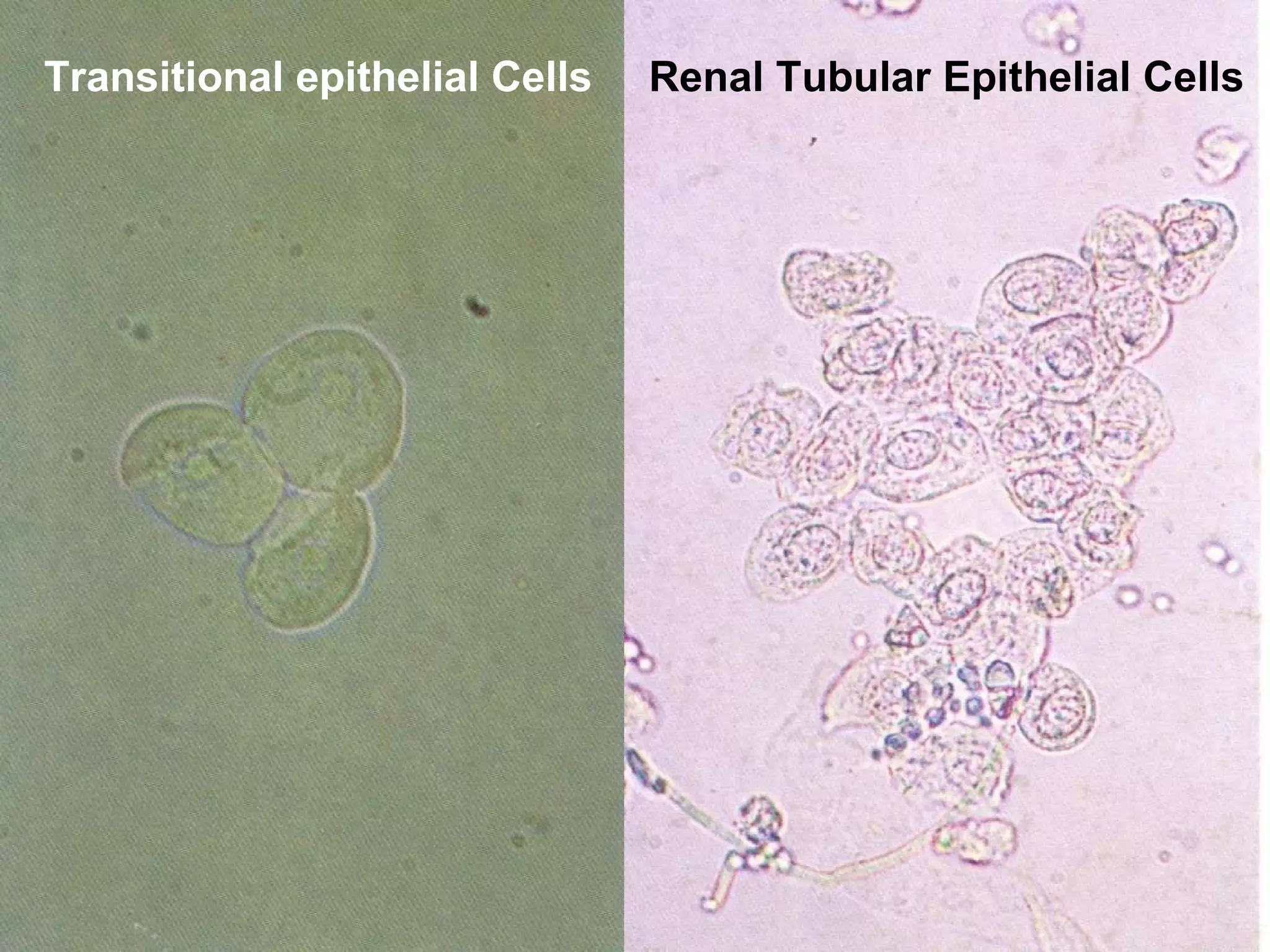 Transitional epithelial Cells Renal Tubular Epithelial Cells 