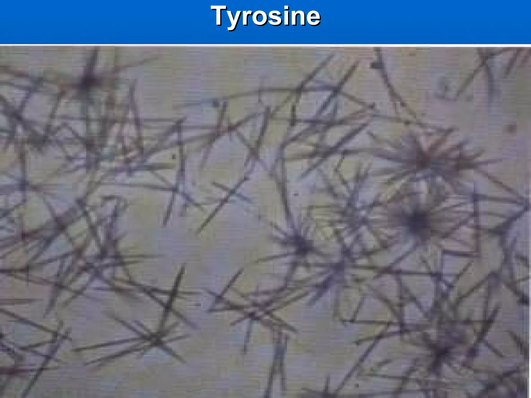 Tyrosine 
