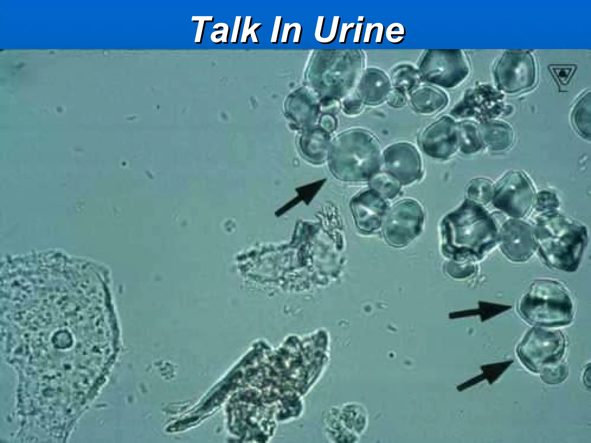Talk In Urine 