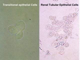 Transitional epithelial Cells Renal Tubular Epithelial Cells 