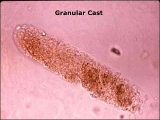 Granular Cast 