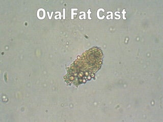 Oval Fat Cast 