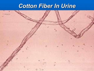 Cotton Fiber In Urine 
