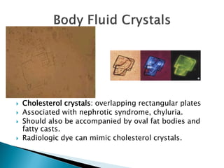 Cholesterol Crystals In Urine Polarized