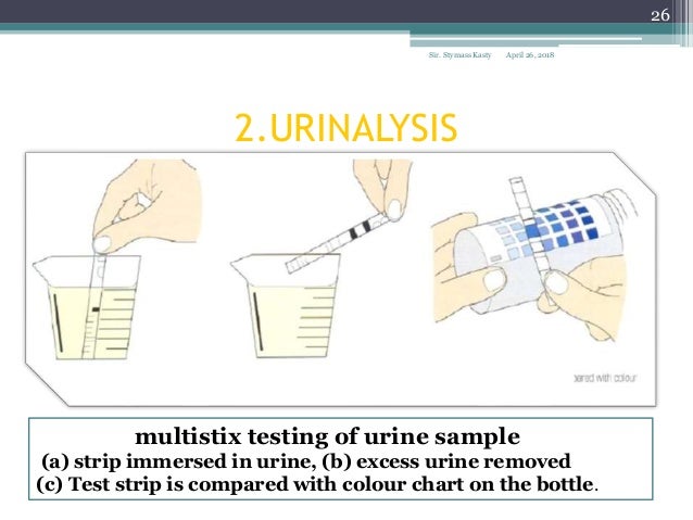 Urine Test Colour Chart