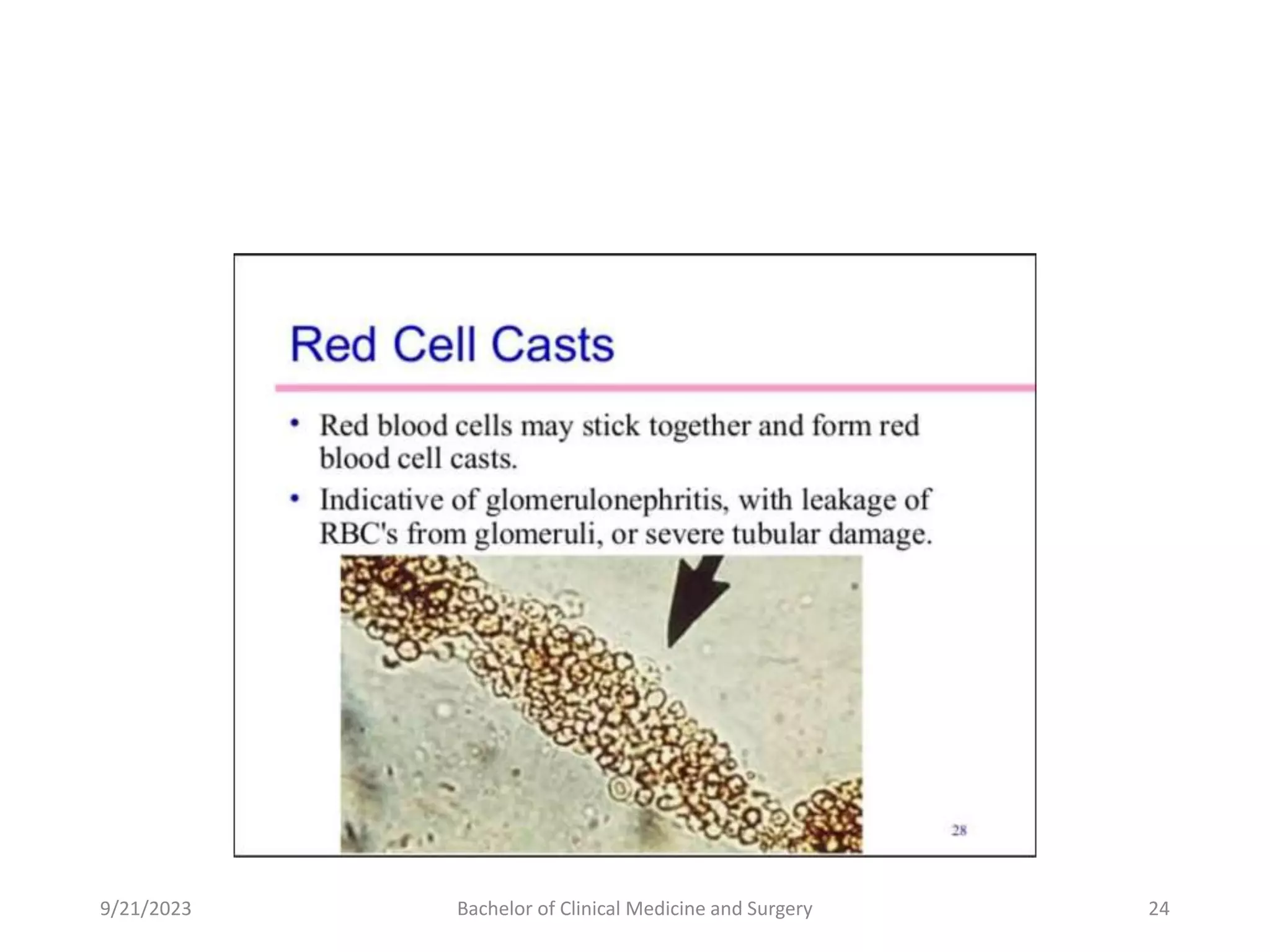 9/21/2023 Bachelor of Clinical Medicine and Surgery 24
 