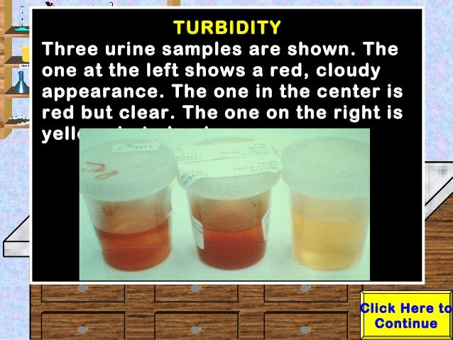 Urine Turbidity Chart