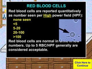 8 Rbcs Urinalysis lab powerpoint.ppt