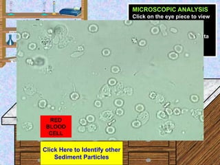 Urine Sample
START
MICROSCOPIC ANALYSIS
Click on the eye piece to view
the sample at High power.
Identify and quantify the...
