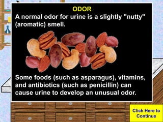Urine Sample
ODOR
A normal odor for urine is a slightly "nutty"
(aromatic) smell.
Some foods (such as asparagus), vitamins...