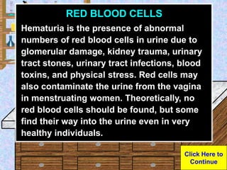 Urine Sample
RED BLOOD CELLS
Hematuria is the presence of abnormal
numbers of red blood cells in urine due to
glomerular d...