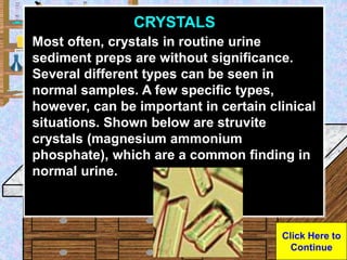 Urine Sample
CRYSTALS
Most often, crystals in routine urine
sediment preps are without significance.
Several different typ...