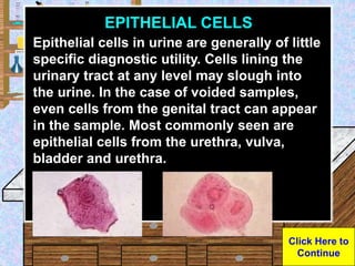 Urine Sample
EPITHELIAL CELLS
Epithelial cells in urine are generally of little
specific diagnostic utility. Cells lining ...