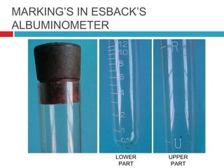 MARKING’S IN ESBACK’S
ALBUMINOMETER
LOWER
PART
UPPER
PART
 