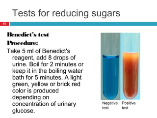 Tests for reducing sugars
60
Benedict’s test
Procedure:
Take 5 ml of Benedict's
reagent, add 8 drops of
urine. Boil for 2 minutes or
keep it in the boiling water
bath for 5 minutes. A light
green, yellow or brick red
color is produced
depending on
concentration of urinary
glucose.
Negative
test
Positive
test
 
