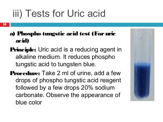 test blood glucose procedure pregnancy Neeraj biochemical Dr Urinalysis