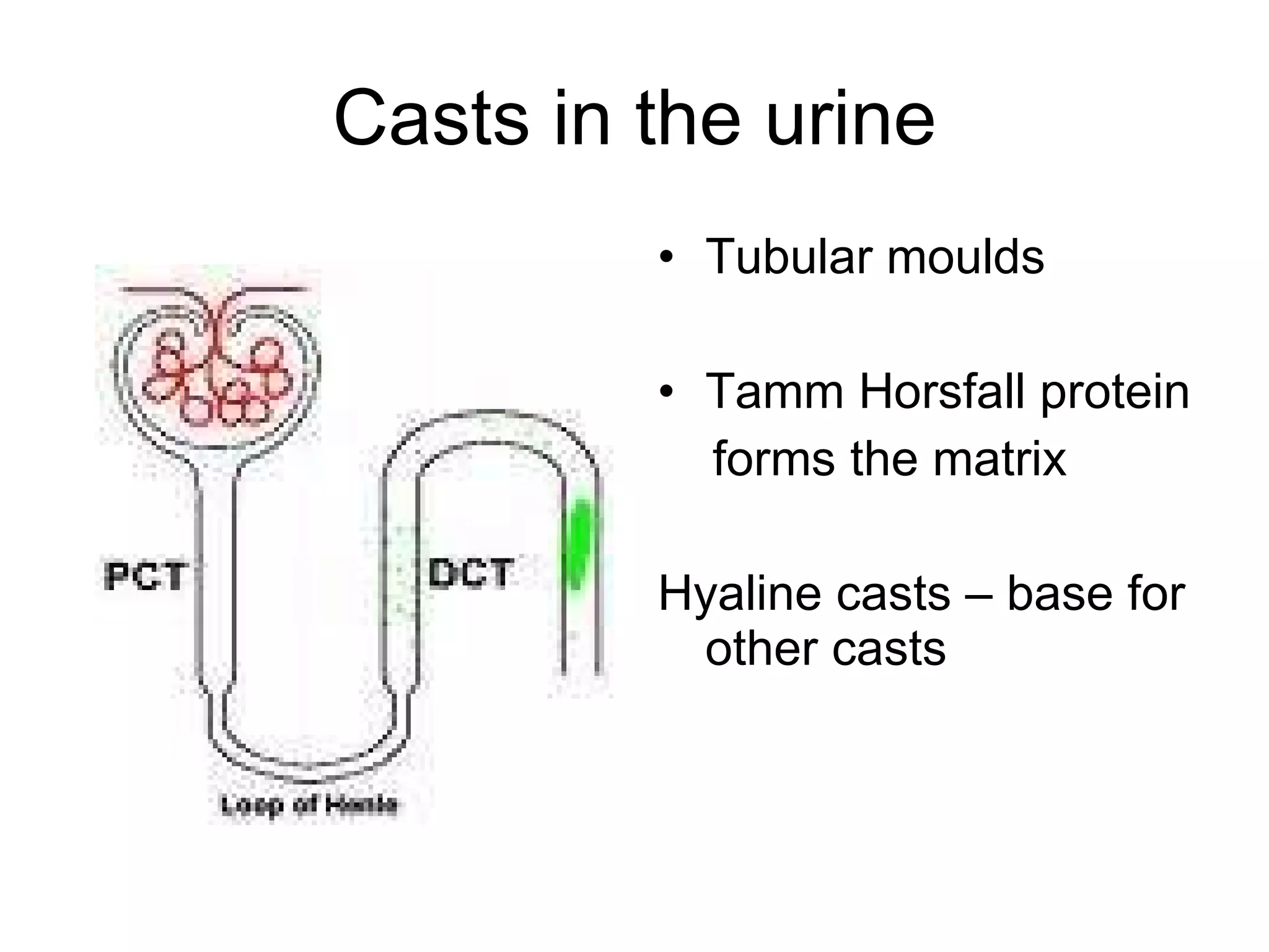 Casts in the urine Tubular moulds Tamm Horsfall protein forms the matrix  Hyaline casts – base for other casts 