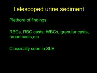 Telescoped urine sediment Plethora of findings RBCs, RBC casts, WBCs, granular casts, broad casts,etc Classically seen in SLE 