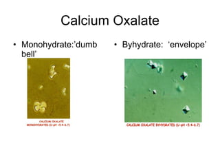 Calcium Oxalate Monohydrate:’dumb bell’ Byhydrate:  ‘envelope’ 