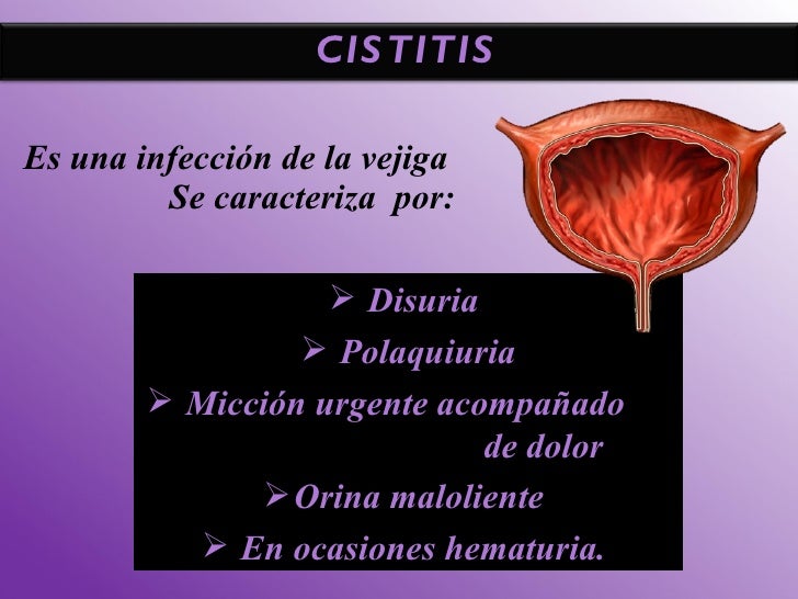 La escoliosis de la columna vertebral a los niños los métodos del tratamiento