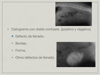 Cistograma con doble contraste. (positivo y negativo) Defecto de llenado. Bordes. Forma. Otros defectos de llenado. 