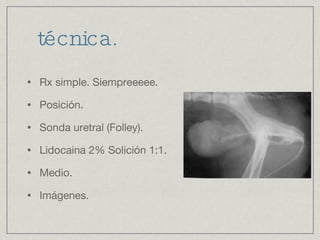 técnica. Rx simple. Siempreeeee. Posición. Sonda uretral (Folley). Lidocaina 2% Solición 1:1. Medio. Imágenes. 
