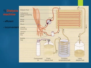 1) Dialysis
machine
- efficient
- inconvenient
vivek
sir
 