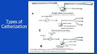 Urinary-and-Bowel-Elimination HEALTH ASSESSMENT | PDF