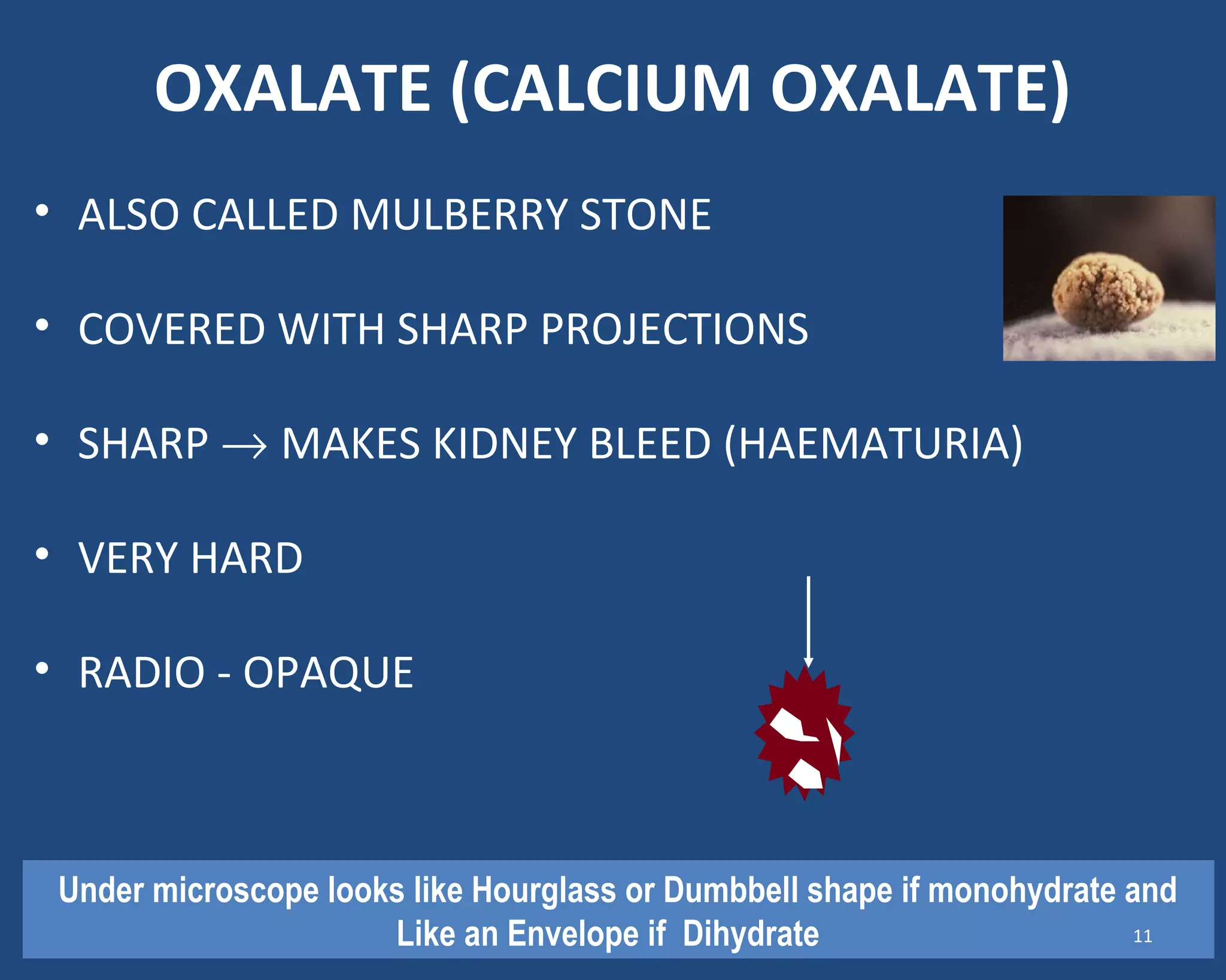 OXALATE (CALCIUM OXALATE)
• ALSO CALLED MULBERRY STONE
• COVERED WITH SHARP PROJECTIONS
• SHARP → MAKES KIDNEY BLEED (HAEMATURIA)
• VERY HARD
• RADIO - OPAQUE
Under microscope looks like Hourglass or Dumbbell shape if monohydrate and
Like an Envelope if Dihydrate 11
 