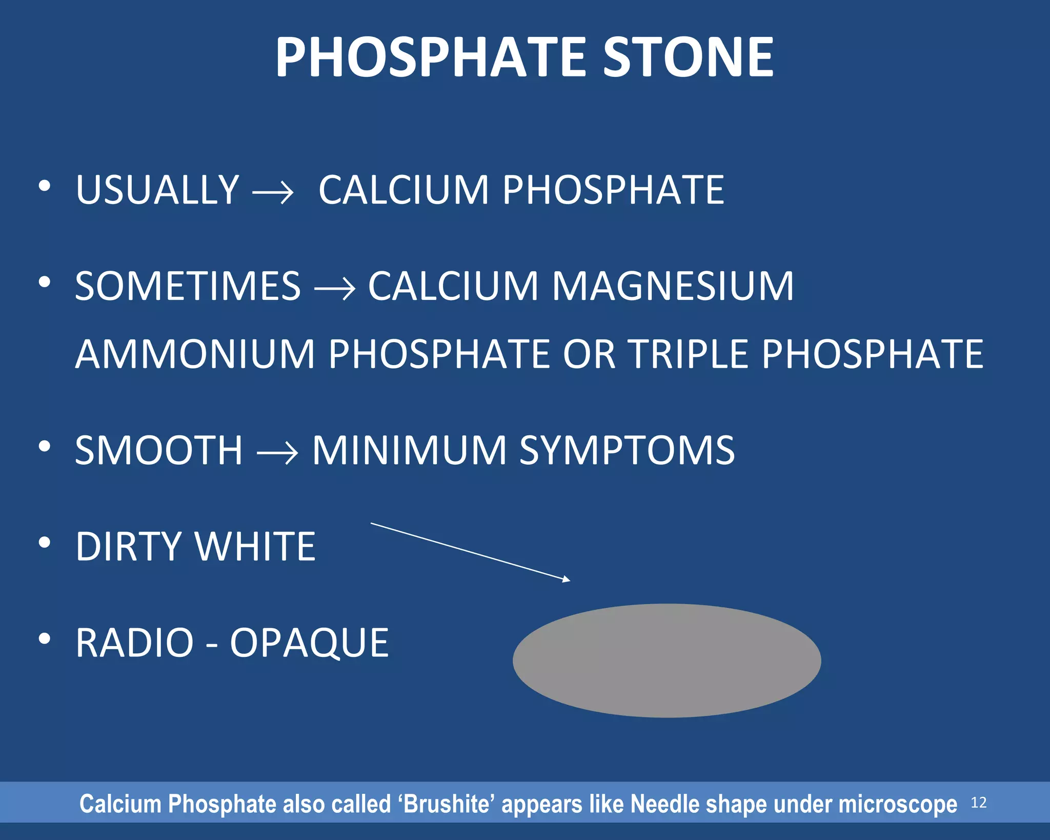 PHOSPHATE STONE
• USUALLY → CALCIUM PHOSPHATE
• SOMETIMES → CALCIUM MAGNESIUM
AMMONIUM PHOSPHATE OR TRIPLE PHOSPHATE
• SMOOTH → MINIMUM SYMPTOMS
• DIRTY WHITE
• RADIO - OPAQUE
Calcium Phosphate also called ‘Brushite’ appears like Needle shape under microscope 12
 
