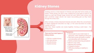 Kidney Stones
A kidney stone is a hard deposit of minerals and salts that forms inside your
kidney. These stones can vary in size, ranging from a tiny grain of sand to as
large as a golf ball (though larger stones are rare). While small stones may
pass unnoticed, larger stones can cause excruciating pain as they travel
through the urinary tract.
Urine normally contains dissolved minerals and salts. When the concentration
of these substances becomes too high, or the urine becomes too acidic,
crystals can form.
Over time, these crystals can clump together, forming a solid mass – the
kidney stone.
There are four main types of
kidney stones:
Calcium oxalate stones
Uric acid stones
Struvite stones.
Cystine stones
Symptoms:
Severe pain in your lower back or
abdomen, often radiating to the groin
Pain that comes and goes in waves
and intensifies with movement
Painful urination (burning sensation)
Blood in your urine
Nausea and vomiting
Frequent urination
Difficulty urinating or inability to
urinate
 