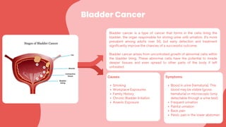 Bladder Cancer
Bladder cancer is a type of cancer that forms in the cells lining the
bladder, the organ responsible for storing urine until urination. It's more
prevalent among adults over 50, but early detection and treatment
significantly improve the chances of a successful outcome.
Bladder cancer arises from uncontrolled growth of abnormal cells within
the bladder lining. These abnormal cells have the potential to invade
deeper tissues and even spread to other parts of the body if left
untreated.
Causes:
Smoking
Workplace Exposures
Family History
Chronic Bladder Irritation
Arsenic Exposure
Symptoms:
Blood in urine (hematuria). This
blood may be visible (gross
hematuria) or microscopic (only
detectable through a urine test).
Frequent urination
Painful urination
Back pain
Pelvic pain in the lower abdomen
 
