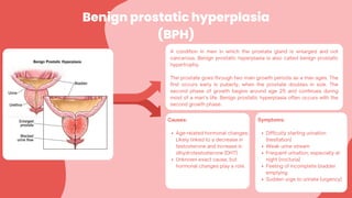 Benign prostatic hyperplasia
(BPH)
A condition in men in which the prostate gland is enlarged and not
cancerous. Benign prostatic hyperplasia is also called benign prostatic
hypertrophy.
The prostate goes through two main growth periods as a man ages. The
first occurs early in puberty, when the prostate doubles in size. The
second phase of growth begins around age 25 and continues during
most of a man’s life. Benign prostatic hyperplasia often occurs with the
second growth phase.
Causes:
Age-related hormonal changes:
Likely linked to a decrease in
testosterone and increase in
dihydrotestosterone (DHT).
Unknown exact cause, but
hormonal changes play a role.
Symptoms:
Difficulty starting urination
(hesitation)
Weak urine stream
Frequent urination, especially at
night (nocturia)
Feeling of incomplete bladder
emptying
Sudden urge to urinate (urgency)
 