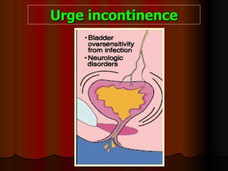 Urge incontinence 