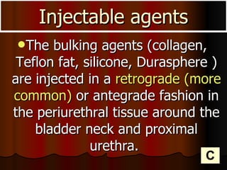 The bulking agents (collagen, Teflon fat, silicone, Durasphere ) are injected in a  retrograde (more common)  or antegrade fashion in the periurethral tissue around the bladder neck and proximal urethra.  Injectable agents C 