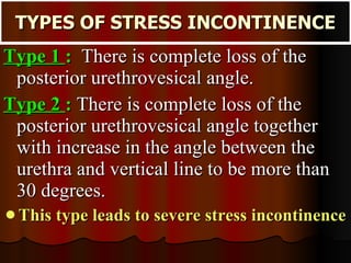 TYPES OF STRESS INCONTINENCE Type 1  :   There is complete loss of the posterior urethrovesical angle.  Type 2  :   There is complete loss of the posterior urethrovesical angle together with increase in the angle between the urethra and vertical line to be more than 30 degrees.  This type leads to severe stress incontinence 