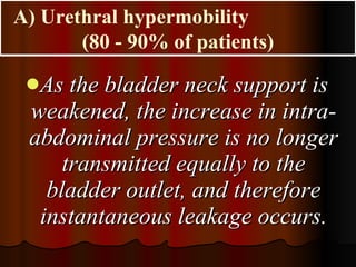 As the bladder neck support is weakened, the increase in intra-abdominal pressure is no longer transmitted equally to the bladder outlet, and therefore instantaneous leakage occurs. A) Urethral hypermobility  (80 - 90% of patients) 