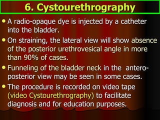 A radio-opaque dye is injected by a catheter into the bladder.  On straining, the lateral view will show  absence of the posterior urethrovesical angle in more than 90% of cases.  Funneling of the bladder neck  in the  antero-posterior view may be seen in some cases.  The procedure is recorded on video tape  (video Cystourethrography)  to facilitate diagnosis and for education purposes. 6. Cystourethrography 