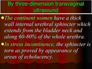 By three-dimension transvaginal ultrasound The   continent women  have a thick wall internal urethral sphincter which extends from the bladder neck and along 60-80% of the whole urethra.  In stress incontinence , the sphincter is torn as proved by appearance of areas of echolucency.  