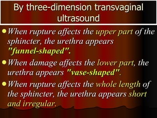 When rupture affects the  upper part  of the sphincter, the urethra appears  "funnel-shaped".   When damage affects the  lower part , the urethra appears  "vase-shaped" .   When rupture affects the  whole length  of the sphincter, the urethra appears  short and irregular. By three-dimension transvaginal ultrasound 