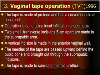 3.  Vaginal tape operation  (TVT) 1996 The tape is made of prolene and has a curved needle at each end.  Operation is done using local infiltration anaesthesia.  Two small  transverse incisions 5 cm apart are made in the suprapubic area.  A vertical incision is made in the anterior vaginal wall.  The needles of the tape are passed upward behind the pubic bone and brought out through the suprapubic incisions.  The tape is made to surround the mid-urethra. 