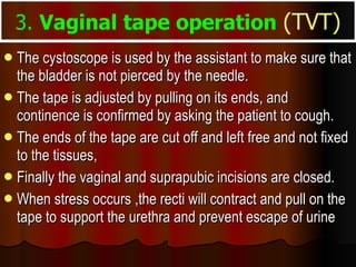 The cystoscope is used by the assistant to make sure that the bladder is not pierced by the needle.  The tape is adjusted by pulling on its ends, and continence is confirmed by asking the patient to cough.  The ends of the tape are cut off and left free and not fixed to the tissues,  Finally the vaginal and suprapubic incisions are closed. When stress occurs ,the recti will contract and pull on the tape to support the urethra and prevent escape of urine  3.  Vaginal tape operation   (TVT) 