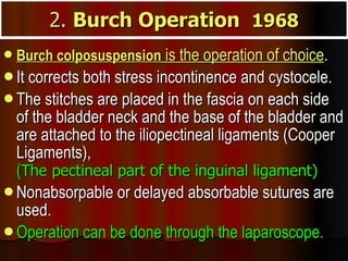 2.  Burch Operation  1968 Burch colposuspension  is the operation of choice .  It corrects both stress incontinence and cystocele.  The stitches are placed in the fascia on each side of the bladder neck and the base of the bladder and are attached to the iliopectineal ligaments (Cooper Ligaments),  ( The pectineal part of the inguinal ligament)   Nonabsorpable or delayed absorbable sutures are used.  Operation can be done through the laparoscope.   