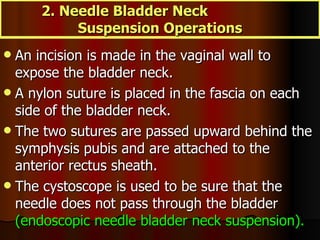 An incision is made in the vaginal wall to expose the bladder neck.  A nylon suture is placed in the fascia on each side of the bladder neck.  The two sutures are passed upward behind the symphysis pubis and are attached to the anterior rectus sheath.  The cystoscope is used to be sure that the needle does not pass through the bladder  (endoscopic needle bladder neck suspension).   2. Needle Bladder Neck  Suspension Operations 
